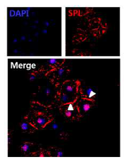 면역 염색을 통한 타액선 세포 및 조직의 스캐폴드 단백 SPL 발현규명