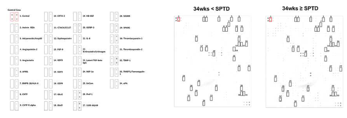 자궁경관무력증시 자궁경부봉축술 후 치료경과에 따른 양수의 antibody microarray 분석