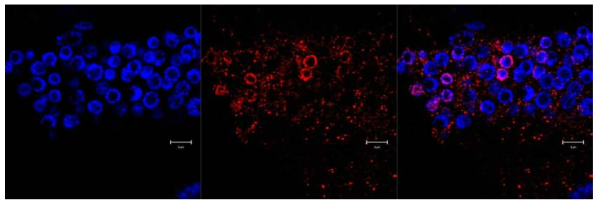 VIG-1 is localized in the perinuclear regions of the gonad cells after UV treatment. Following UV treatment, wild-type worms were treated with a VIG-1 antibody (red) and a DNA-staining Hoechst dye (blue). The merged pattern (right panel) indicates that VIG-1 moves to the perinuclear regions of the gonad cells. Scale bar, 5 μm