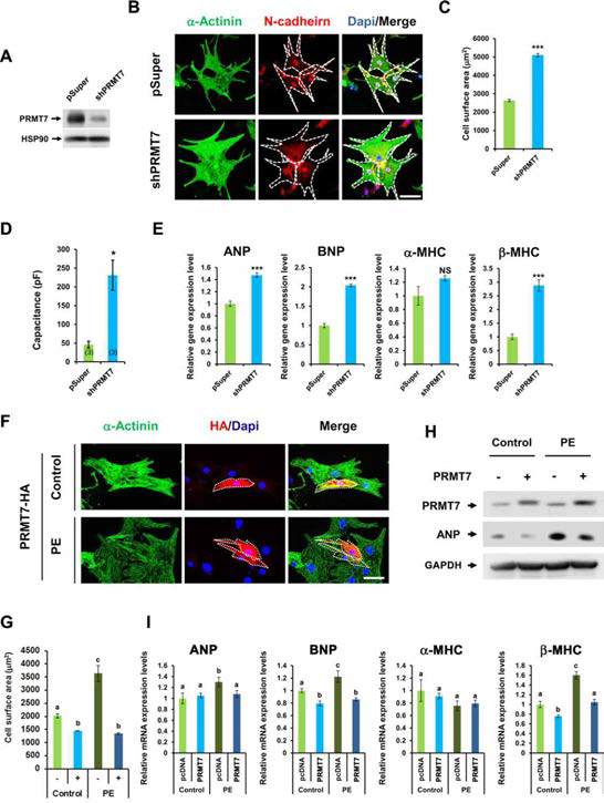 PRMT7이 결손된 심근세포 (NRVM, New born Rat ventricular cardiomyocyte) 의 표현형을 분석함. (A-C) shRNA-PRMT7을 사용하여 NRVM cell의 PRMT7을 결핍시킨 경우 NRVM의 세포 표면적이 증가되어 있는 것을 확인함. (D) 또한 patch clamp를 사용하여 세포의 capacitance (전기용량)을 분석한 결과, PRMT7이 결핍된 NRVM에서 cellular capacitance가 증가되어 있음을 확인함. (E) 또한 심근 세포 비대의 marker로 알려진 ANP, BNP, b-MHC 의 발현이 PRMT7이 결핍된 NRVM cell에서 유의적으로 증가되어 있음을 확인함. (F-G) 뿐만아니라 PRMT7이 과발현 된 NRVM 의 경우, cellular area가 세포 비대 유도약물인 PE(phenylephrine)의 처리에도 증가하지 않는 것을 확인함. (H-I) qRT-PCR을 통하여 ANP, BNP, b-mhc의 발현이 유의적으로 감소하는 것을 확인함 이는 PRMT7이 세포비대를 억제하는 중요한 역할을 할수 있음을 나타냄