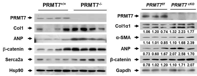 PRMT7이 결손된 심장의 단백질 발현 분석. PRMT7이 결손된 심장 (PRMT7-/-, PRMT7 cKO) 의 단백질 발현을 분석함, 심근 비대 및 심근 섬유화가 진행될 시, 발현이 증가하는 Col1, ANP, a-SMA b-catenin 의 발현이 대조군 생쥐에 비해 PRMT7이 결손된 심장에서 높게 발현되는 것을 확인함. 이는 PRMT7이 결손될 경우 심근 비대 및, 심근 섬유화의 진행이 증가되는 것을 나타냄