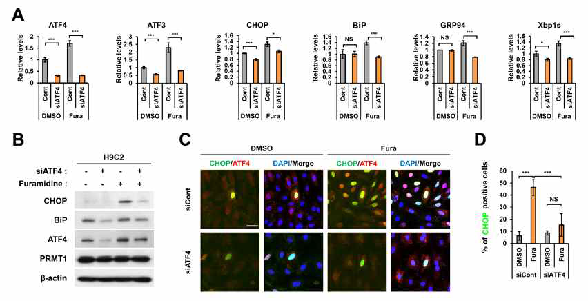 PRMT1의 억제에 의해 발생되는 ER stress response가 ATF4의 knockdown에 의해 회복됨. (A-B) Furamidine 처리에 의한 ER stress markergene의 발현이 ATF4의 knockdown에 의해 회복 되는 것을 qRT-PCR과 Western blot을 통해 확인함. (C-D) Control siRNA가 도입된 H9C2 cell의 경우 Furamidine의 처리에 의해서 ATF4/CHOP의 발현이 증가되는 것을 보이지만 siATF가 도입된 cell의 경우 ATF4/CHOP의 발현이 control cell 수준으로 감소되는 것을 확인함