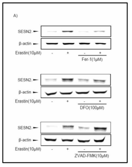 세포 사멸에 관련된 억제제들을 이용한 Erastin에 의한 Sestrin2 단백질 발현의 변화