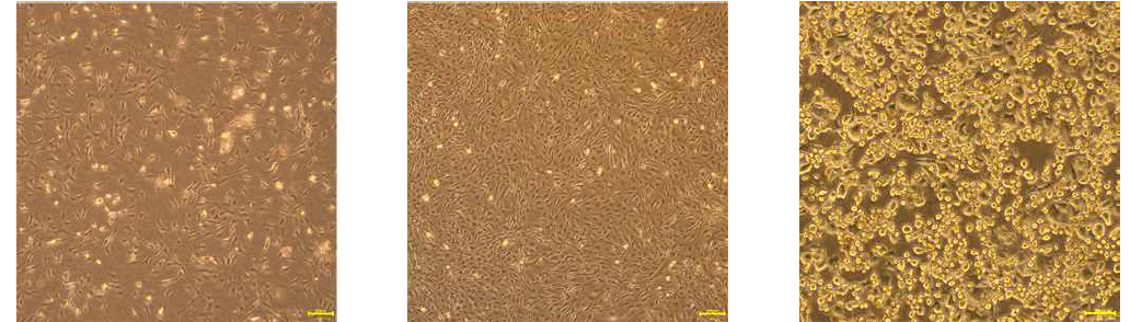 전지방세포 3T3-L1의 지방세포로의 분화 유도 - Preadipocyte 3T3-L1 cell line (왼쪽), 100% confluence preadipocyte 3T3-L1 (가운데), adipocyte 3T3-L1 (오른쪽)
