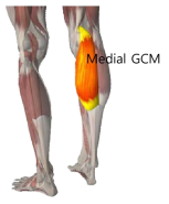 내측 비복근의 위치