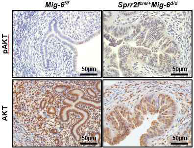 Sprr2fcre/+Mig-6f/f 마우스 자궁에서의 AKT 인산화 증가