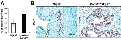 Sprr2fcre/+Mig-6f/f 마우스 자궁 상피세포의 세포분열 증가