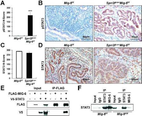 Sprr2fcre/+Mig-6f/f 마우스 자궁에서의 STAT3 단백질의 인산화 증가와 MIG-6-STAT3 단백질간 결합