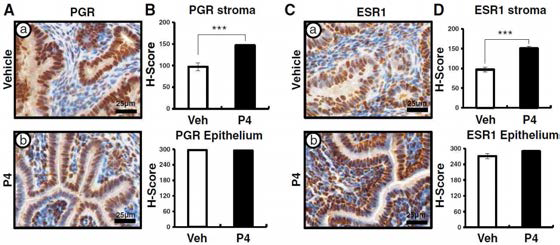 Mig-6d/d 마우스의 자궁기질에서 감소된 PGR과 ESR1의 단백질량이 P4 처리에 의해 회복됨