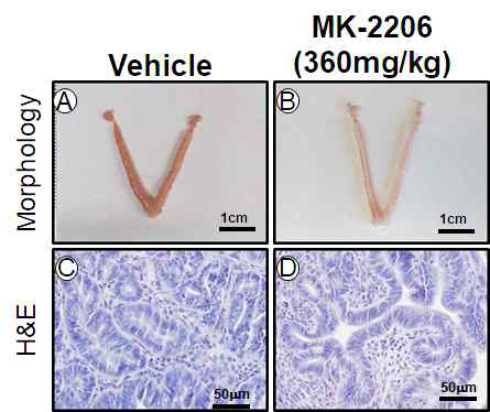 MK-2206 처리에 의한 자궁내막의 조직학적 변화