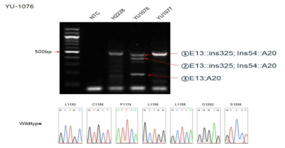 sanger sequencing 및 RT-PCR로 환자유래세포주의 ALK fusion 확인