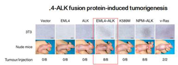 EML4-ALK fusion 단백질에 의한 종양 형성