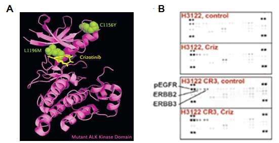 (A) ALK 유전자 kinase domain 내의 crystal 구조와 L1196M. C1156Y 돌연변이. (B) Crizotinib 내성 H3122 (EML4-ALK 폐암 세포주)에서의 EGFR 시그날 활성화