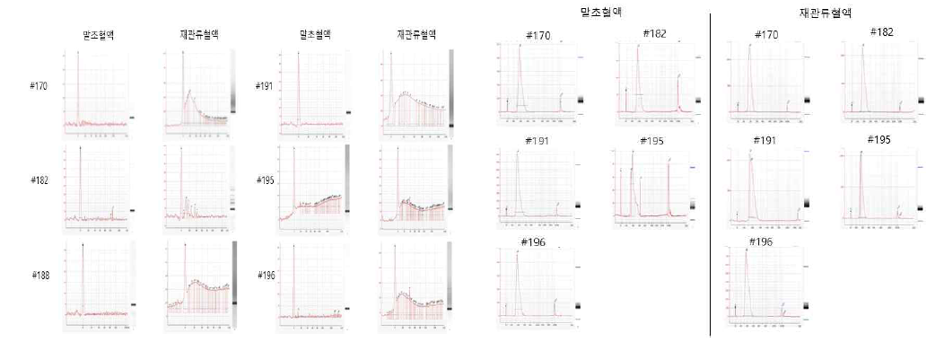 뇌사자신장이식 허혈재관류손상시 발생되는 R전기영동에 의한 RNA 및 라이브러리 QC 확인