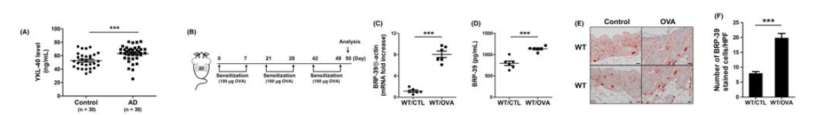 아토피피부염 환자 및 마우스 모델에서 YKL‐40/BRP-39의 발현 증가 확인. A, 아토피피부염 환자 혈청에서 YKL‐40 level B, OVA를 이용한 아토피피부염 마우스 모델 유도 방법. C, 아토피피부염 마우스 모델에서 BRP‐39의 mRNA 발현량과 (D) protein level. E, IHC of BRP‐39 and (F) BRP‐39+cells의 quantification (400 배율)