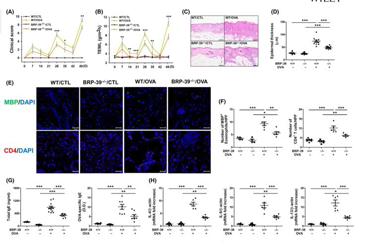 아토피피부염이 유도된 BRP‐39−/− 마우스에서 Th2 염증반응 감소 확인.(A) Clinical score, (B) TEWL levels, (C) H&E staining (200 배율), (D) epidermal thickness, (E) MBP+ eosinophils and CD4+ T cells의 IF, (F) eosinophils 과 CD4 T cells의 quantification (400배율), (G) Total IgE 와 OVA‐specific IgE levels,（H）Th2 cytokines mRNA 발현량