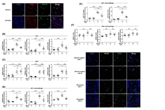 아토피피부염 환자 및 마우스의 skin macrophage에서 BRP‐39/YKL‐40의 발현 및 M2‐like TEWL levels, (C) H&E staining (200 배율), (D) epidermal thickness, (E) MBP+ eosinophils and CD4+ T cells의 IF, (F) eosinophils 과 CD4 T cells의 quantification (400배율), (G) Total IgE 와 OVA ‐specific IgE levels,（H）Th2 cytokines mRNA 발현량