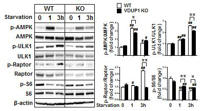 절식 후 정상 및 VDUP1 결손 간세포에서 AMPK/ULK1/Raptor/mTOR signal pathway 비교