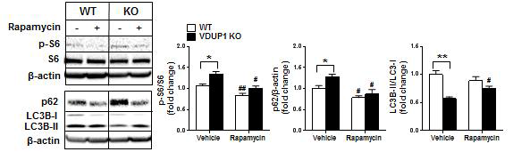 rapamycin처리후 간세포에서 자가포식 비교