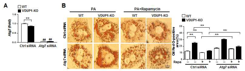 Rapamacin 및 ATG7 siRNA 처리 후 PA에 의한 지방 축적 비교
