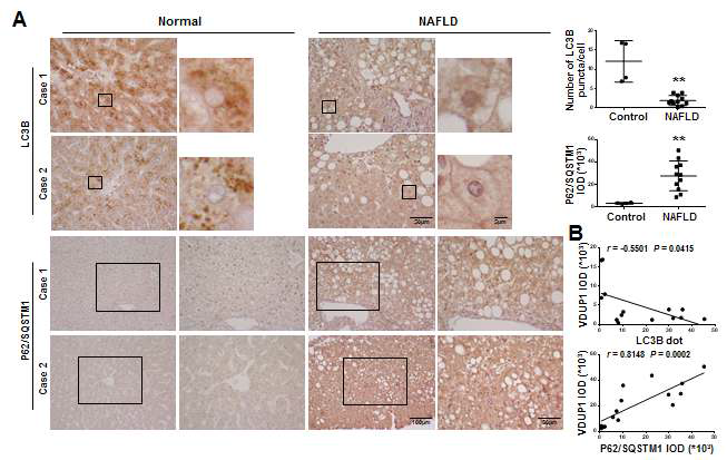 NAFLD 환자에서 LC3 및 p62/SQSTM1의 발현 및 VDUP1과의 상관성 분석