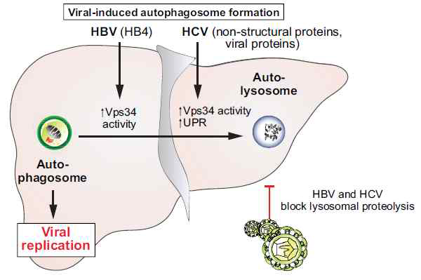 HBV감염에 의한 간질환과 자가포식