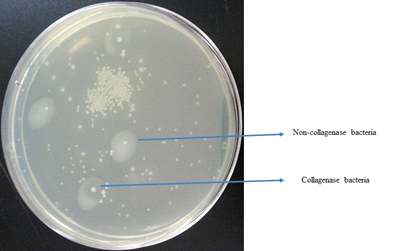 Collagenase와 non-collagenase생성 박테리아의 차이