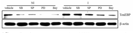 Effect of JNK, NF-κB, ERK, and p38 inhibition on TonEBP expression