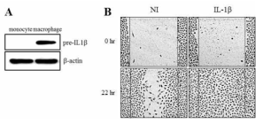 Effect of IL-1β on migration of lung cancer cells