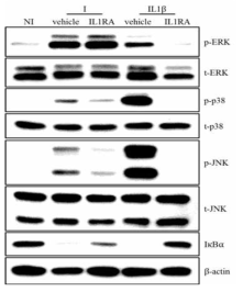 Effect of IL1 receptor antagonist on ERK, p38, JNK and NF-κB pathways