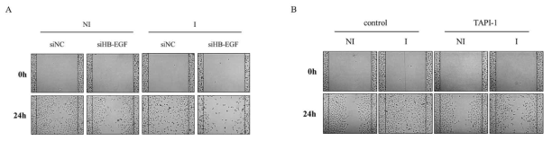 Effect of HB-EGF expression and cleavage on migration in A549 cells