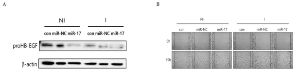 HB-EGF regulated by miR-17 mediated macrophage