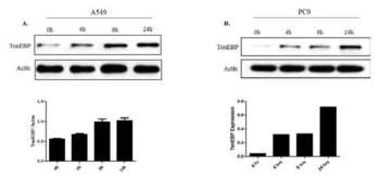 Time dependent expression of TonEBP in macrophage CM-induced lung cancer cells