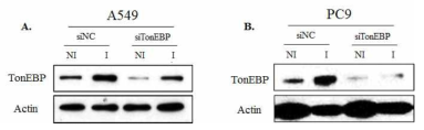 Expression of TonEBP in lung cancer cells transfected with each siRNA