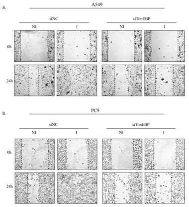 Measuring migration ability of lung cancer cells through wound healing assay after transfection of siRNA and incubation in macrophage CM