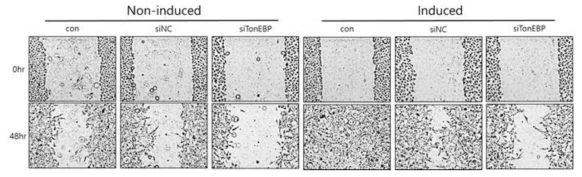 Effect of TonEBP expression of invasion in macrophage-induced A549 cells