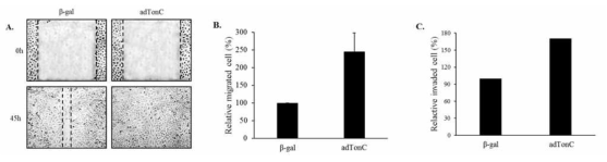 Effect of TonEBP overexpression on migration and invasion ability of lung cancer cells