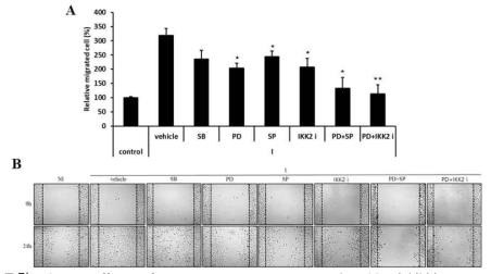 Effect of JNK, NF-κB, ERK, and p38 inhibition on macrophage-induced migration