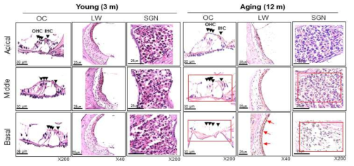 Sections of the cochlea were subjected to histopathologic analyses( H&E staining) in young (3 m, left) and age-related hearing loss (12 m, right) mice