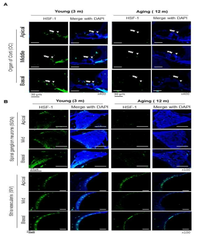 Immunofluorescence with HSF-1 (A) at the organ of Corti, (B) spiral ganglion neuron, stria vascularis in normal young (3 m) and age-related hearing loss (12 m) mice cochlea sections