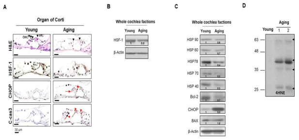 Representative immunohistochemistry and immunoblot analysis of cochlea of young and aged mice with antibodies against (A, second row) HSF-1, (A, third row) CHOP, C-cas3 (A, fourth row).H&E stained sections were used for control. (B) For immunoblot analysis of young and aged mice cochlea with antibodies against HSF-1, (C) HSP90, 60, 78, 70, 40, CHOP, BAX, Bcl-2 and (D) 4-HNE.β-actin was used as the loading control