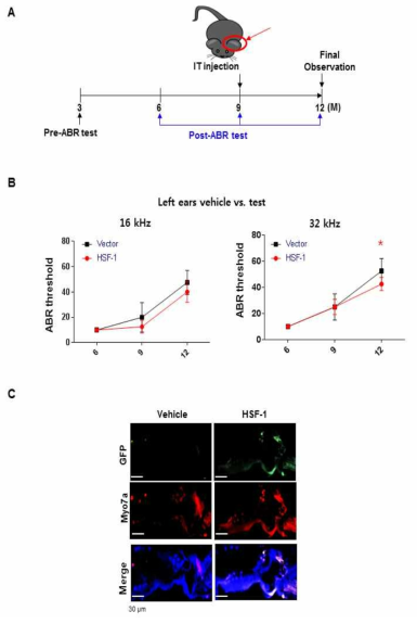 (A) Schematic diagram of the experimental procedure for in vivo using c57/BL6J. (B) Comparison of ABR threshold at 16 and 32 kHz in the 6, 9 and 12 months left ears of aged mice treated with HSF-1 or vector control. Results are means ± SEM of 6 months (n = 8), 9 months (n = 8), for 12 months (n = 5), respectively. P < 0.01, by Student t-test. (C) Comparison of HSF-1 expression by immunofluorescence at the organ of Corti in age-related hearing loss (12 M) mice treated with HSF-1 or vector control. Myosin7a was used for hair cell markers