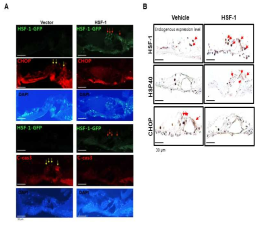 (A) For immunofluorescence analysis of HSF-1 (first & fourth row, red arrow), CHOP (second row, yellow arrow), cleaved caspase-3 (fifth row, yellow arrow) or (B) For Immunohistochemistry analysis of HSF-1 (first row), HSP40 (second row) and CHOP (third row) from the organ of Corti in age-related hearing loss (12 M) mice treated with HSF-1 or vector control. DAPI and hematoxylin staining were used for nuclear counterstain in the fluorescence or Immunohistochemistry