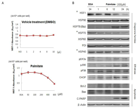 Immunoblot analysis of chaperone families, ER stress makers, apoptosis makers in palmitate treated SIPS-minic conditioned HEI-OC1 cells