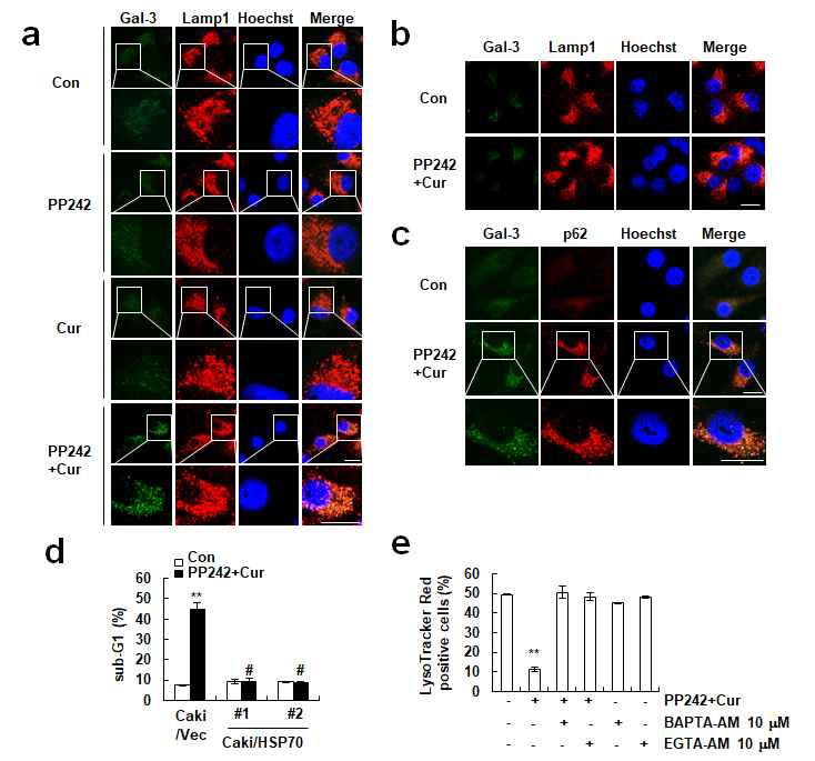 신장암세포에서 PP242와 curcumin에 의한 Lysophagy의 증가 확인 (a) 신장암세포에 PP242와 curcumin을 처리하면 lysophagy를 확인할 수 있는 Galectin-3의 puncta와 Lamp1과의 발현 및 locaization을 확인함. (b) 신장암세포에 PP242와 curcumin을 처리 시 세포사멸이 일어나기 시작하는 24 h에 Galectin-3의 puncta와 Lamp1과의 발현 및 localization을 확인함. (c) Lysophagy가 일어날 때 autophagy machinery를 사용하는지 확인하기 위하여 Galectin-3와 p62의 localization을 확인함. (d) LMP억제 시 PP242와 curcumin에 의한 세포사멸 확인 (e) PP242와 curcumin의 병합처리에 의한 LMP유도 시 calcium과의 관련성을 인함