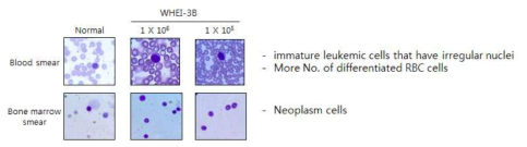 Leukemia model 유도 실험