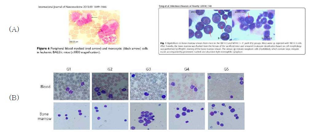 Blood와 bone marrow smear