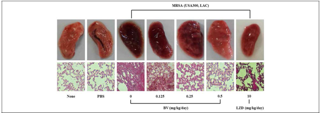 BV protection against S. aureus pneumonia. Gross pathological changes (A) and histopathology (B) of S. aureus-infected lung tissue from mice treated with PBS or various concentration BV (0.125, 0.25 and 0.5 mg/kg) or 10 mg/kg LZD