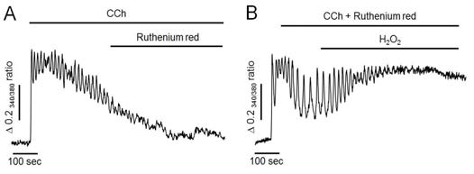 Effect of ruthenium red on H2O2-induced intracellular Ca2+ response in Ca2+-free medium. (A) Representative trace showing the effect of ruthenium red on CCh-induced intracellular Ca2+ response in Ca2+-free medium. (B) Pretreatment of ruthenium red with CCh failed to attenuate H2O2-induced additional elevation of intracellular Ca2+levels