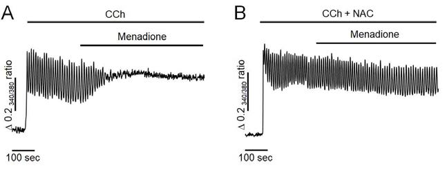 Effects of menadione and NAC, an antioxidant on CCh-induced intracellular Ca2+ oscillation in intact pancreatic acinar cells. The perfusion of menadione resulted in an elevation of intracellular Ca2+ concentration and a termination of Ca2+ oscillation. NAC completely prevent H2O2-induced Ca2+ accumulation